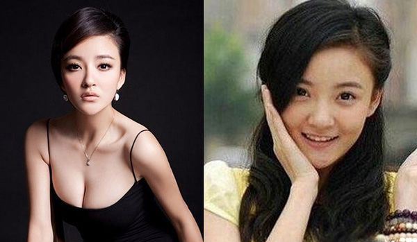 刘雨欣下巴很假 刘雨欣整容了吗？