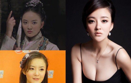 刘雨欣下巴很假 刘雨欣整容了吗？