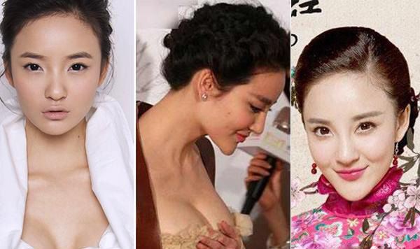 刘雨欣下巴很假 刘雨欣整容了吗？