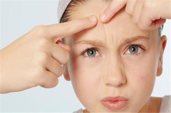 祛痘产品哪个效果好 祛痘产品排行榜