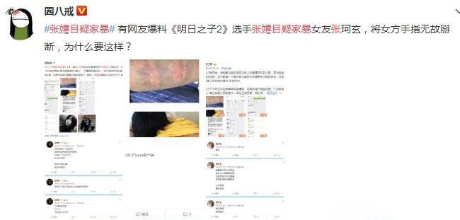 张嫮目疑家暴 被张珂玄列举出几大罪状