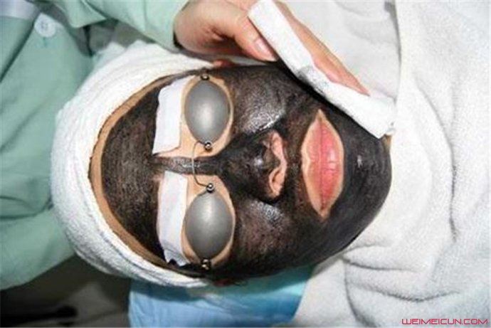 黑脸娃娃效果对比 黑脸娃娃效果怎么样