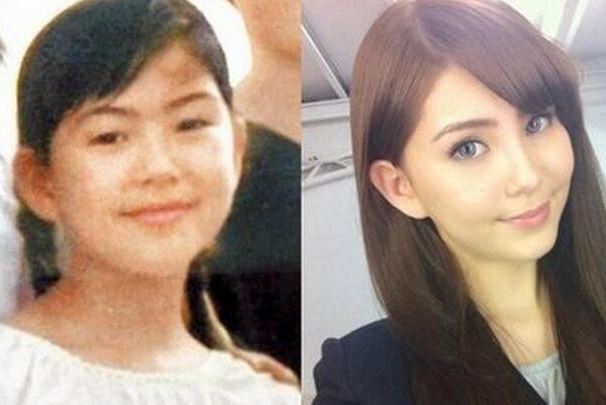 昆凌整容前后对比照流出 网友直呼这直接换了一个脸