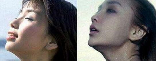 Angelababy杨颖整容前后照片对比 黄晓明都认不出