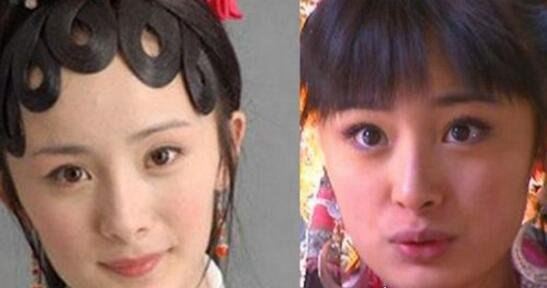 杨幂整容前后照片对比 整容失败留下后遗症曝光