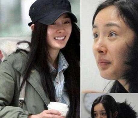 杨幂整容前后照片对比 整容失败留下后遗症曝光