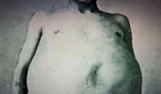 世界最长的人屎 长1.8米重13公斤(被收藏到博物馆中)