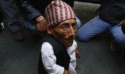 世界最矮的人排名 十大世界最矮袖珍人(最矮一位54.6cm)