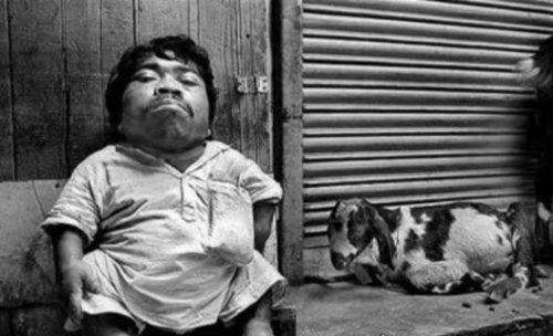 世界最矮的人排名 十大世界最矮袖珍人(最矮一位54.6cm)