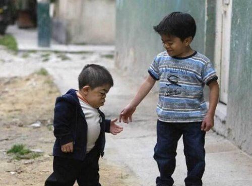 世界最矮的人排名 十大世界最矮袖珍人(最矮一位54.6cm)