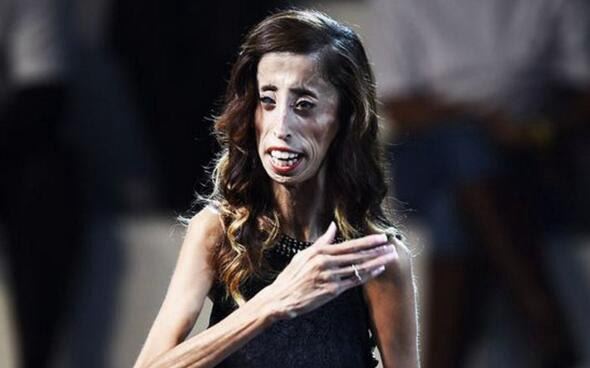 美国零脂肪女孩 丽兹·维拉斯奎兹(体重仅仅只有54斤)