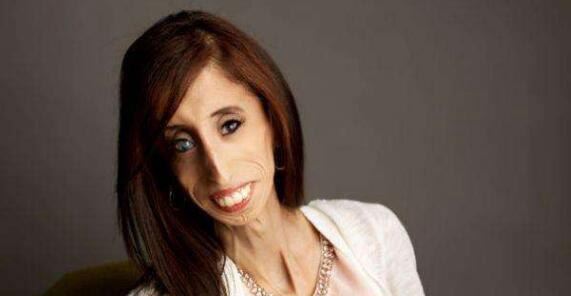 美国零脂肪女孩 丽兹·维拉斯奎兹(体重仅仅只有54斤)