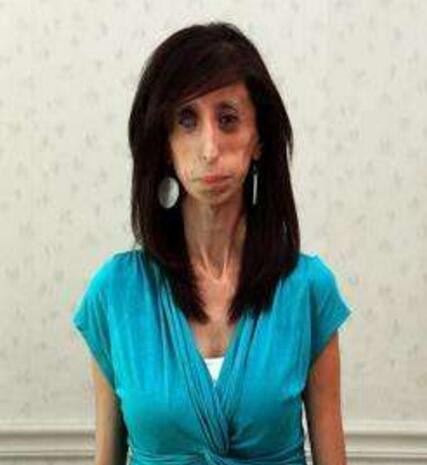 美国零脂肪女孩 丽兹·维拉斯奎兹(体重仅仅只有54斤)