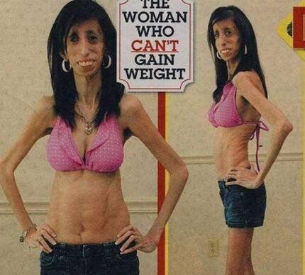 美国零脂肪女孩 丽兹·维拉斯奎兹(体重仅仅只有54斤)