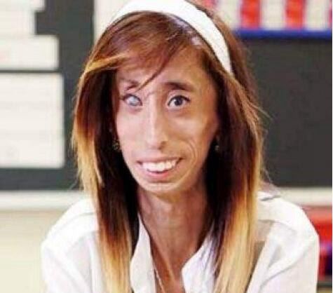 美国零脂肪女孩 丽兹·维拉斯奎兹(体重仅仅只有54斤)