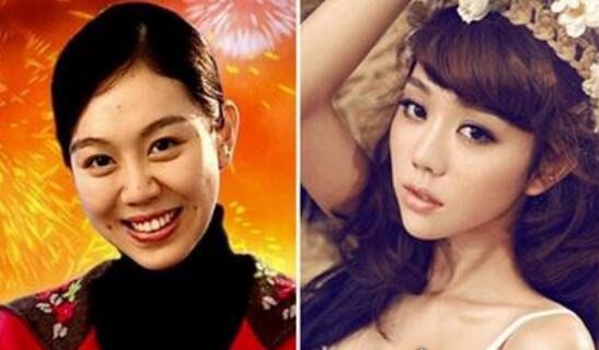 姜妍整容前后照片对比 干妈宋丹丹劝她不要整容