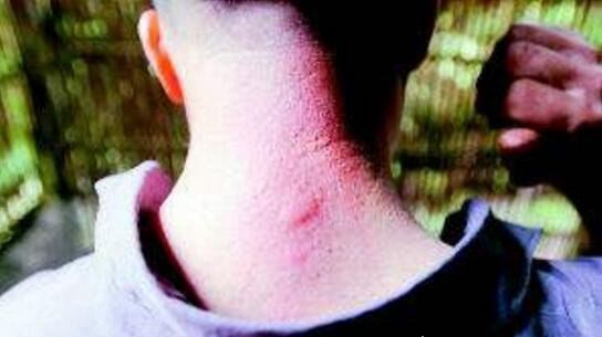 恶心的松毛虫图片 有毒害虫密密麻麻啃食森林