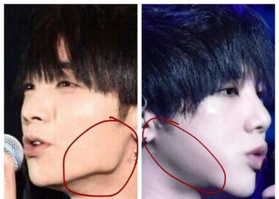 明星整容前后照片盘点 有些明星整容堪比换脸