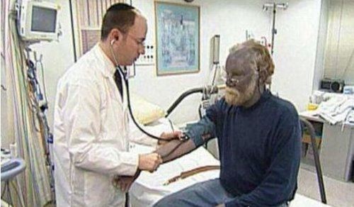 人类的新分支蓝种人 奥坎基查尔族人蓝血液蓝皮肤