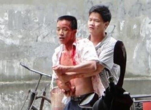 广西柳州飙血哥事件 头破血流还手持木棍要血拼到底