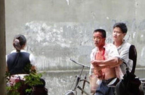 广西柳州飙血哥事件 头破血流还手持木棍要血拼到底