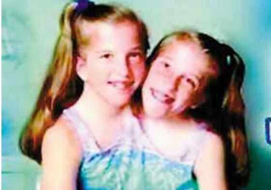 美国双头人 阿比盖尔和布列塔妮(遇感情纠纷/如今27岁)