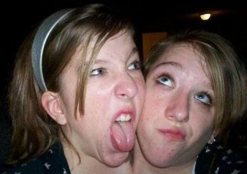 美国双头人 阿比盖尔和布列塔妮(遇感情纠纷/如今27岁)