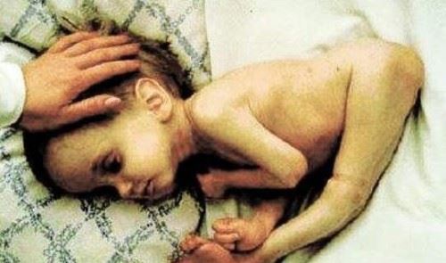 盘点全球十大惊悚地点 特鲁克泻湖横尸遍野成死人堆