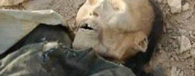 世界上有僵尸吗？北京医院太平间尸体不翼而飞(慎入)