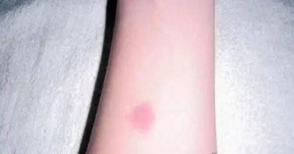 古代守宫砂是什么 守宫砂的原理揭秘(用来检测女性贞超)