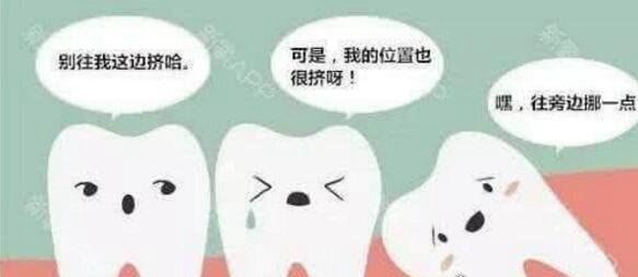 不需要拔的智齿图片 这4种情况下的智齿其实并不需要拔