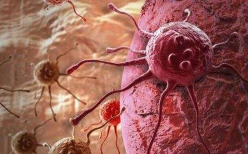 晚期癌症病人死前五个阶段 在此阶段减轻痛苦是关键