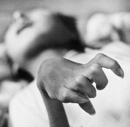 震惊世界的日本水俣病事件 是最早出现的公害病