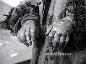 手游现731部队是怎么回事？731部队历史事件揭秘