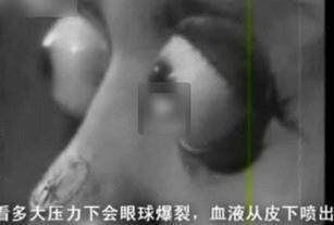 手游现731部队是怎么回事？731部队历史事件揭秘