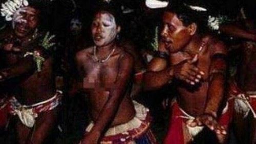 世界上唯一双目失明的民族 盲族血液中尾线虫影响视觉