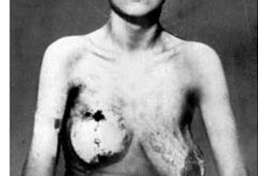 纳粹羞辱残杀妇女恐怖真实黑镜头 妇女儿童成为人体试验品