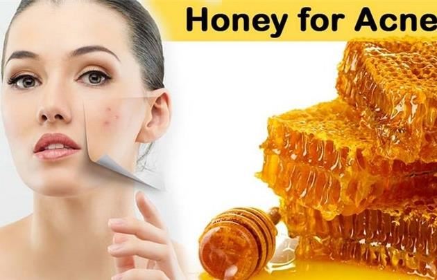 治疗痤疮的最好方法 10种治疗痤疮的方法