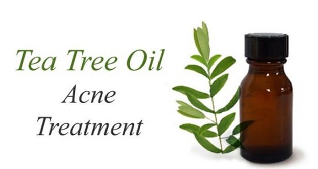 治疗痤疮的最好方法 10种治疗痤疮的方法