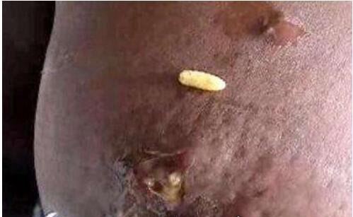 史上最恶心的图片 莲蓬乳/空手指超恶心图片合集(慎入)