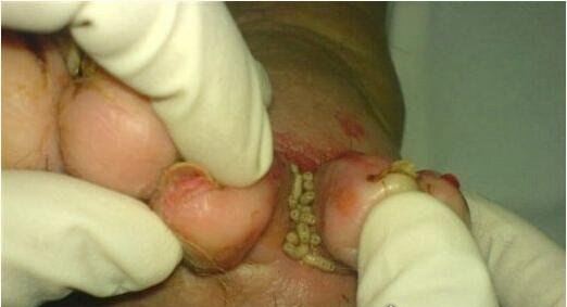 史上最恶心的图片 莲蓬乳/空手指超恶心图片合集(慎入)