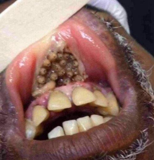 史上最恶心的图片 莲蓬乳/空手指超恶心图片合集(慎入)