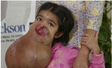 史上最恶心的图片 莲蓬乳/空手指超恶心图片合集(慎入)