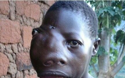 史上最恶心的图片 莲蓬乳/空手指超恶心图片合集(慎入)