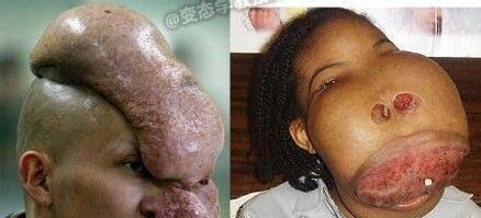 史上最恶心的图片 莲蓬乳/空手指超恶心图片合集(慎入)