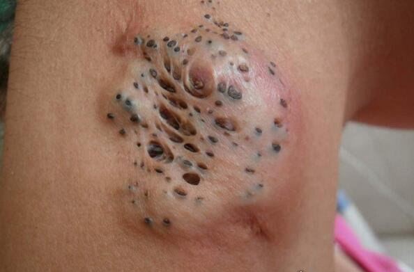 史上最恶心的图片 莲蓬乳/空手指超恶心图片合集(慎入)