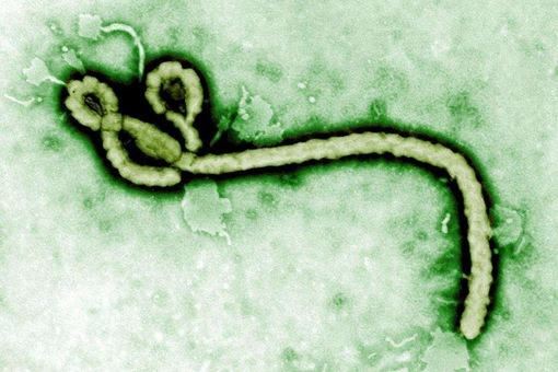 埃博拉病毒怎么消失了 埃博拉病毒有疫苗了吗