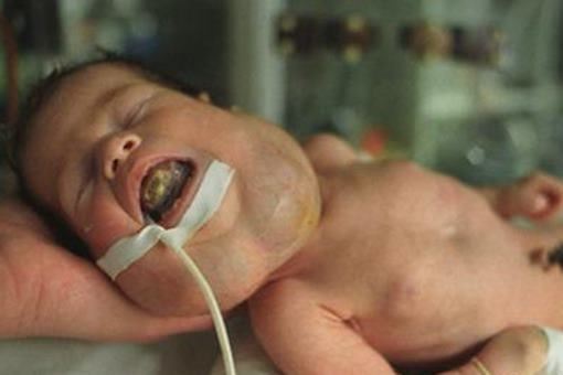 切尔诺贝利事件变种人是什么样的？揭秘切尔诺贝利变异生物