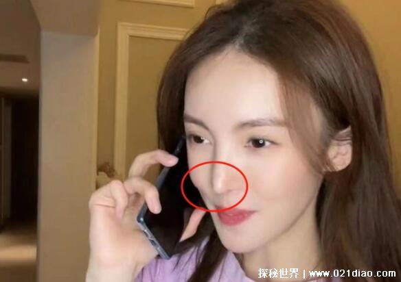 金晨整容呀 对比，鼻子和脸型轮廓明显动过刀子(附对比图)