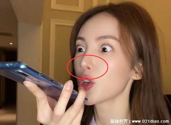 金晨整容呀 对比，鼻子和脸型轮廓明显动过刀子(附对比图)